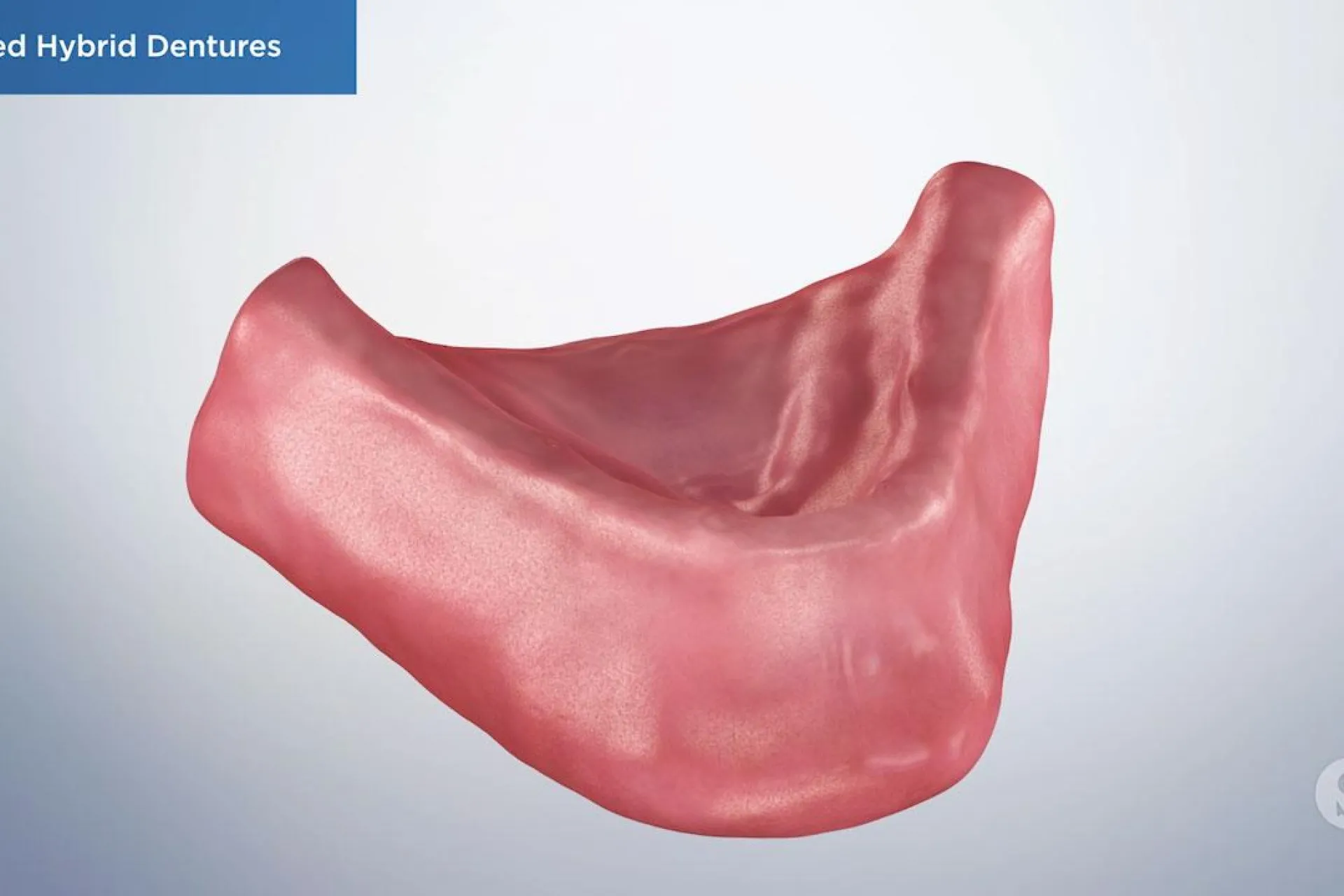 A video still - Fixed Hybrid Dentures with an image showing bottom gum to have dentures be placed on it.