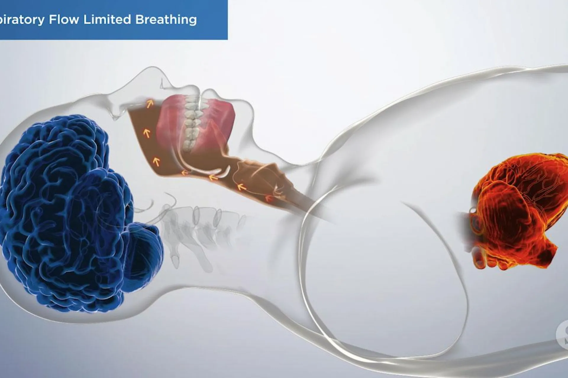 A video still - Inspiratory Flow Limited Breathing with an image showing a person laying down and the airflow coming out of mouth and nose.