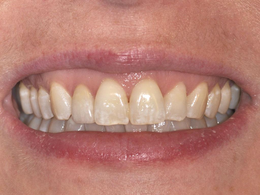 case 013 smile after photo