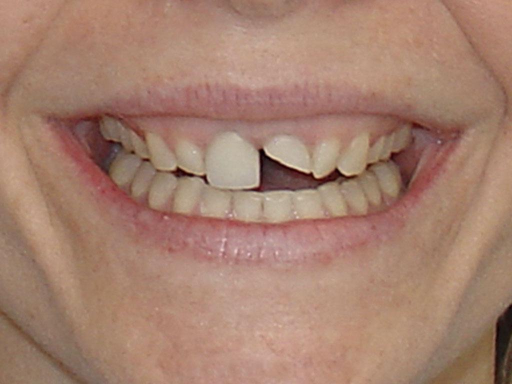 case 019 smile before photo