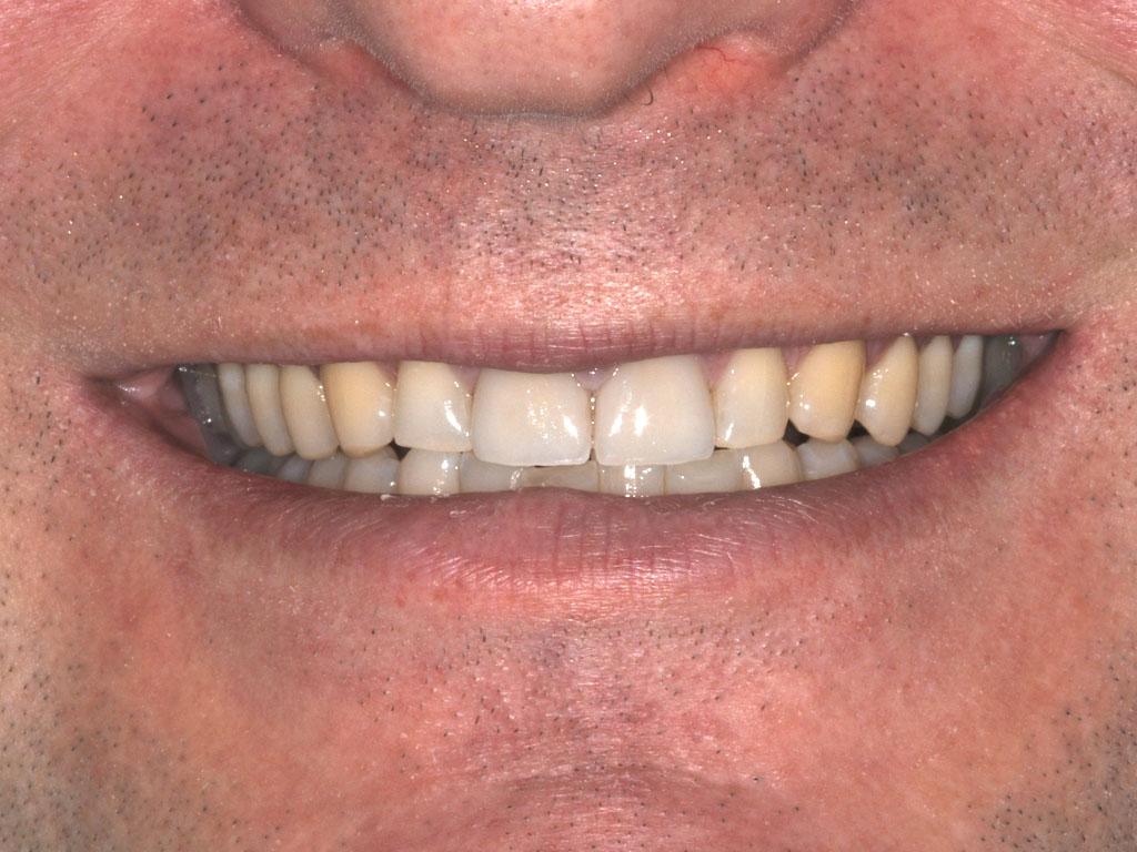 case 032 smile after photo