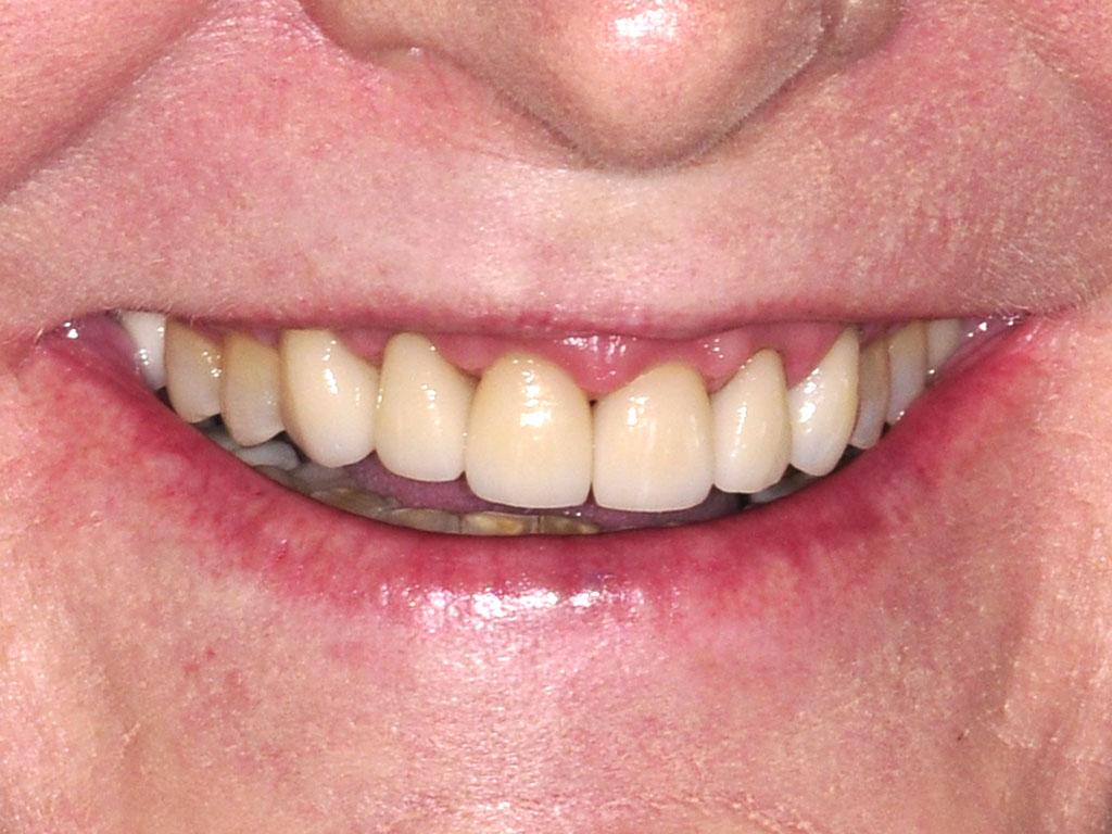 case 037 smile after photo