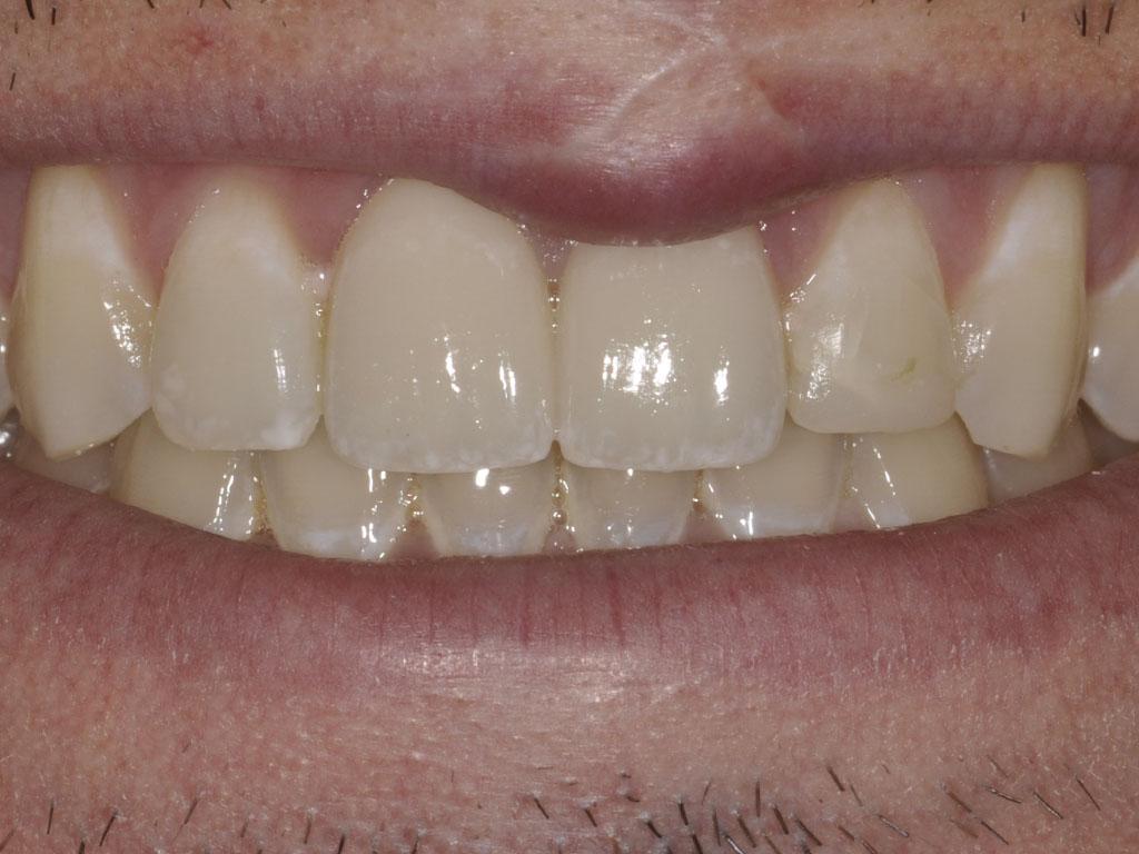 case 041 smile after photo