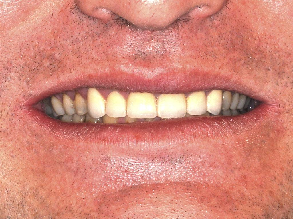 case 043 smile after photo