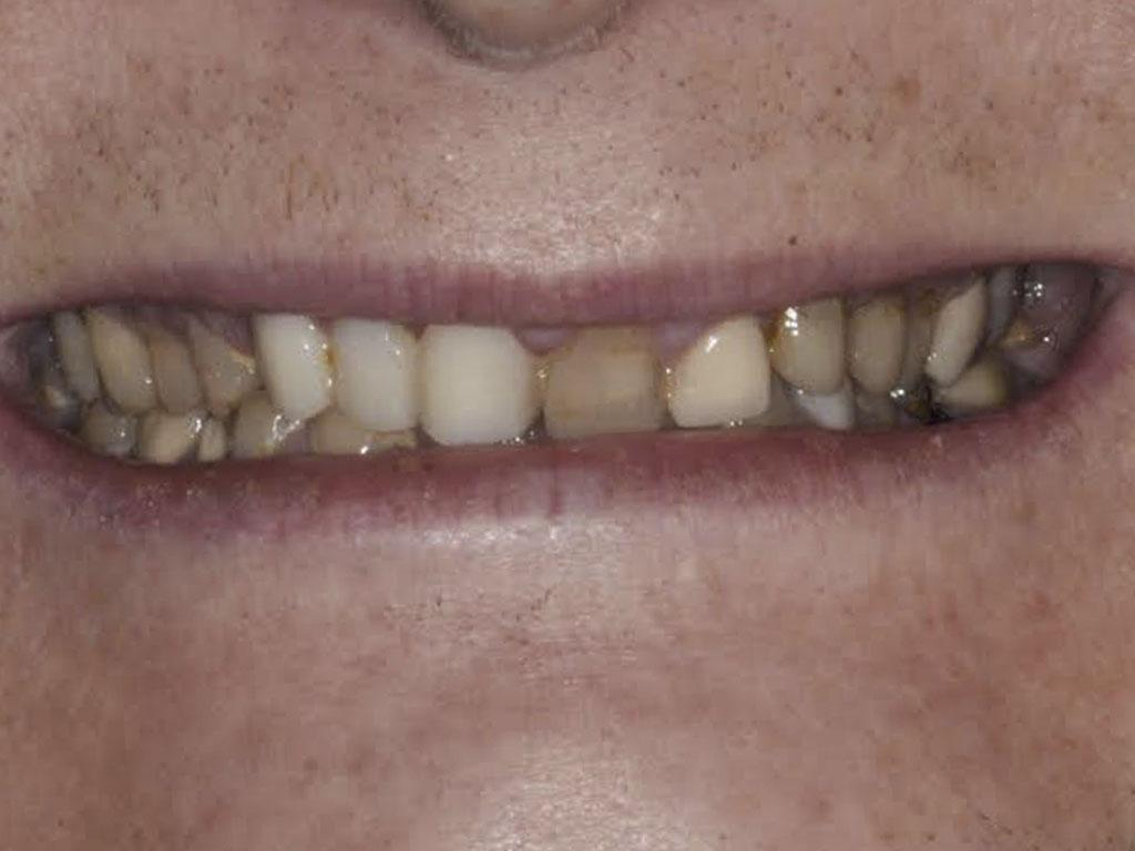 case 045 smile before photo