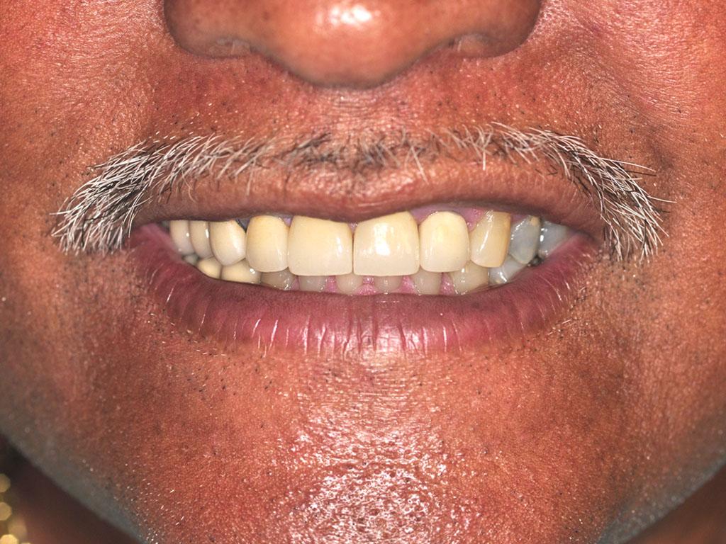 case 057 smile after photo