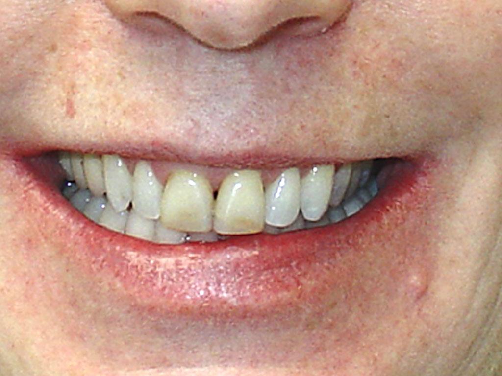 case 060 smile before photo