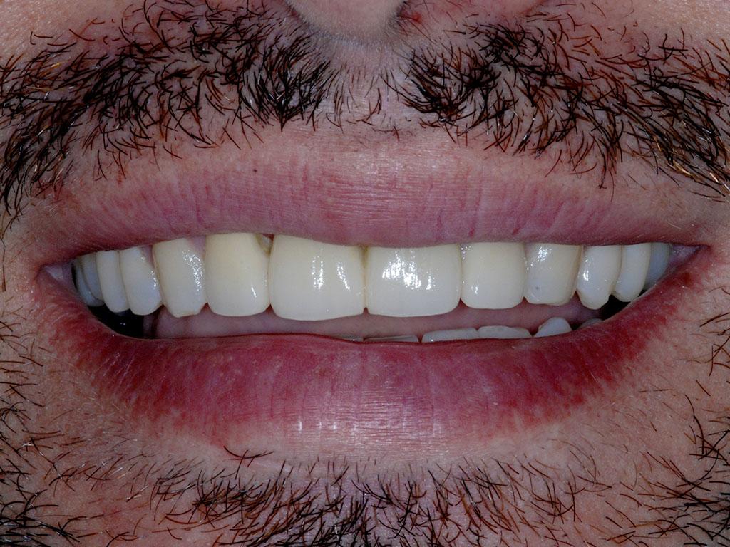 case 073 smile after photo