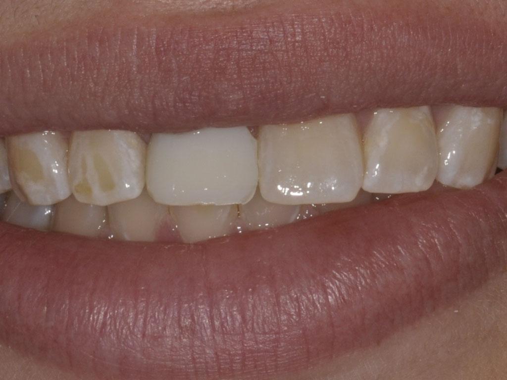 case 074 smile before photo