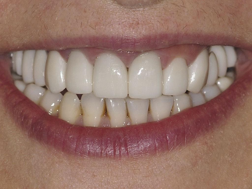 case 078 smile after photo