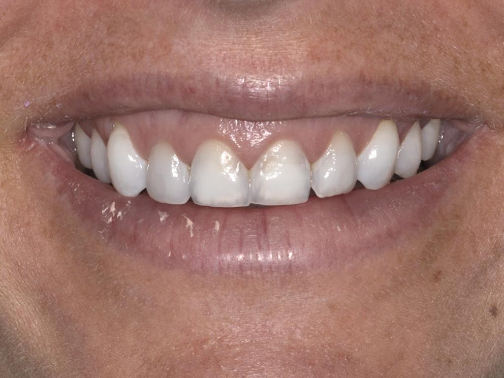 case 088 smile before photo