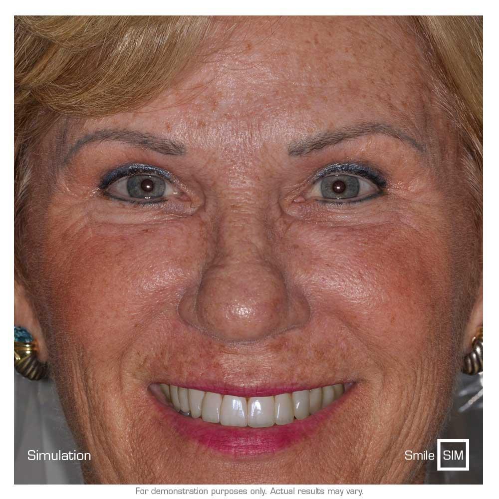 A woman smiling with a simulated smile