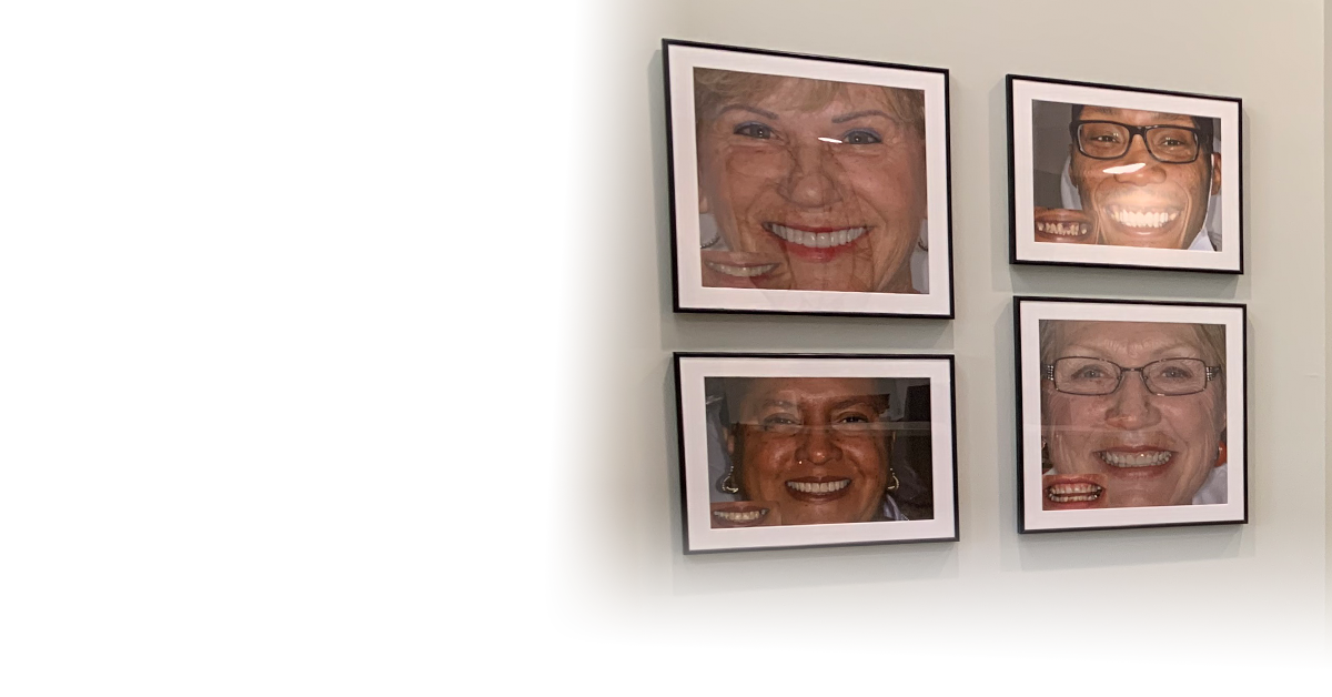 wall of smile gallery