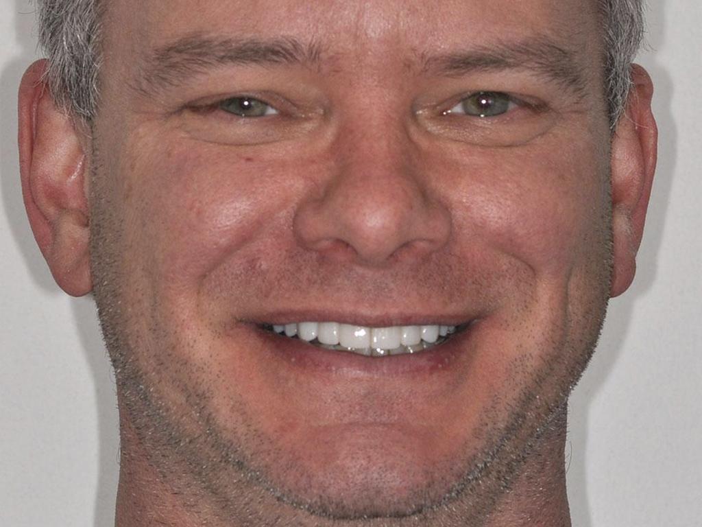 man smiling with nice teeth photo