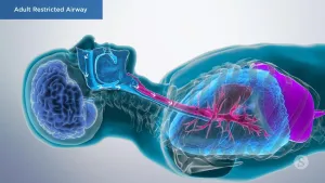 A video still - Adult Restricted Airway with an image showing the anatomy of the nose, throat and lungs.