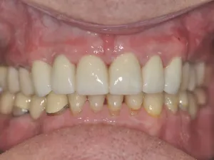 Case 305 retracted after photo