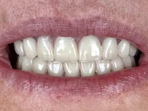 Case 400 retracted after photo