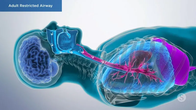 A video still - Adult Myofunctional Therapy with an image showing the anatomy of the breathing and upper airway.