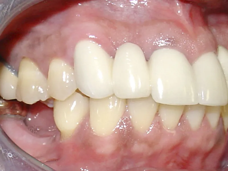 case 002 close up after photo
