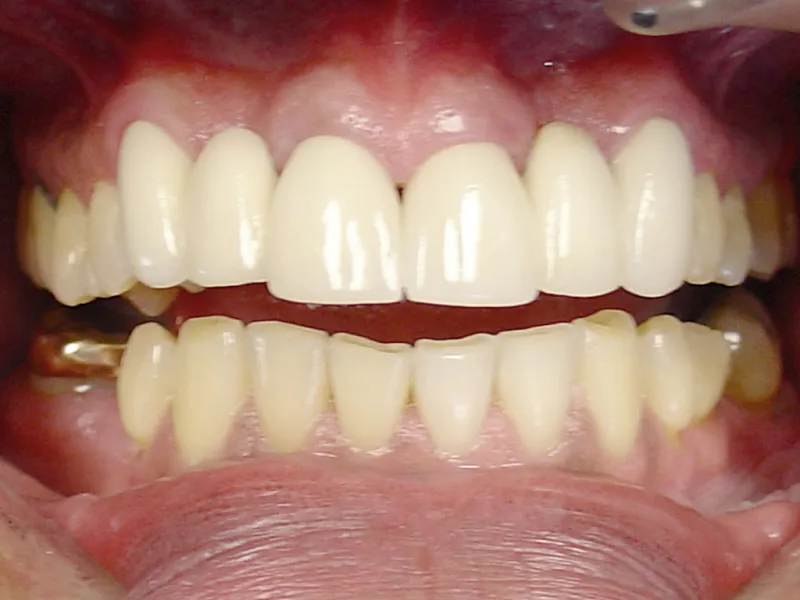 case 002 retracted after photo
