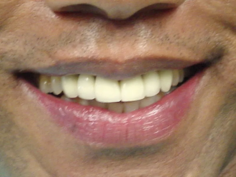 case 002 smile before photo