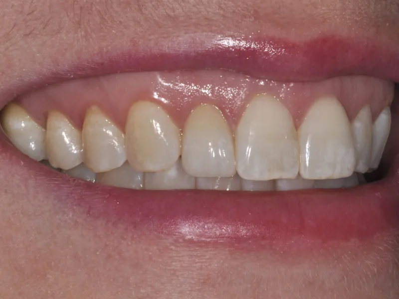 case 008 smile after photo