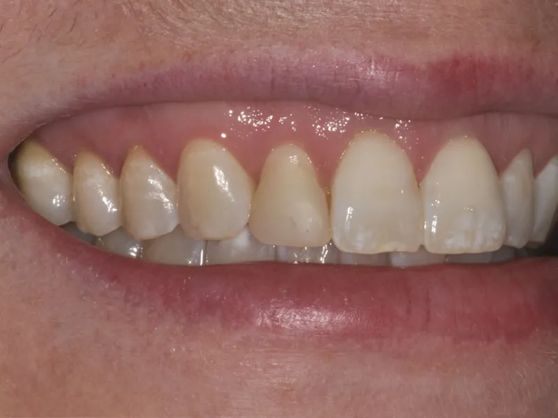 case 008 smile before photo