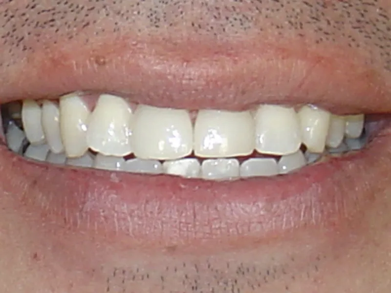 case 009 smile after photo