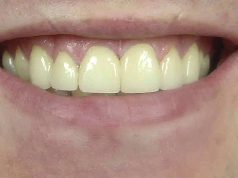 case 010 smile after photo