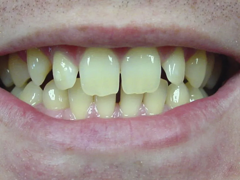 case 010 smile before photo