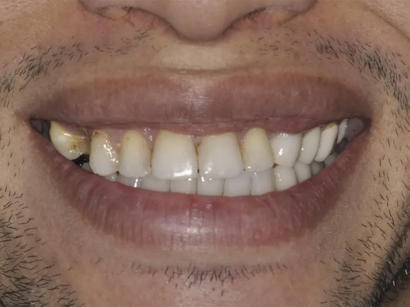 case 0100 smile before photo
