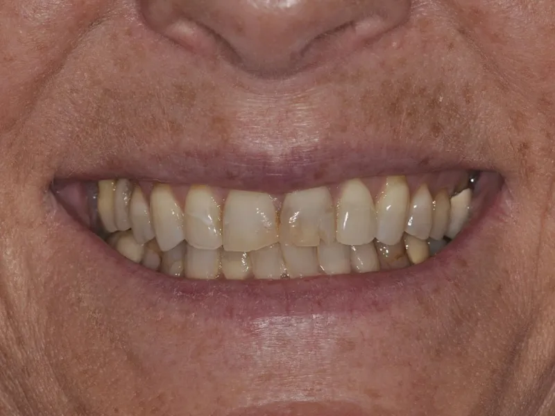 case 0102 smile before photo