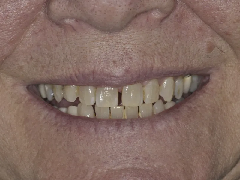 case 0103 smile before photo
