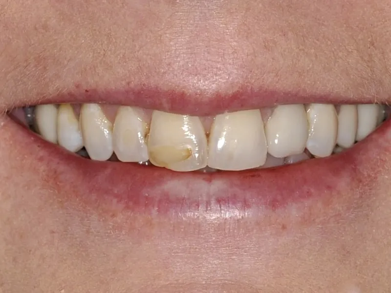 case 0105 smile before photo