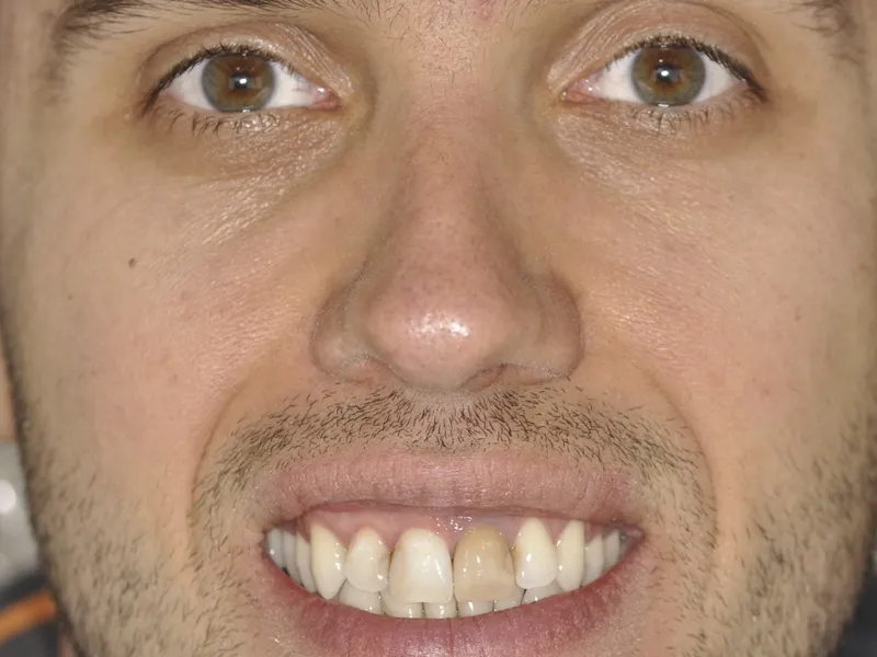 case 0108 full face before photo