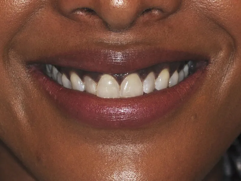 case 0110 smile before photo