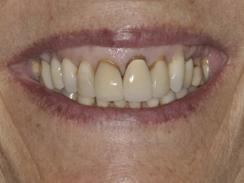 case 0111 smile before photo