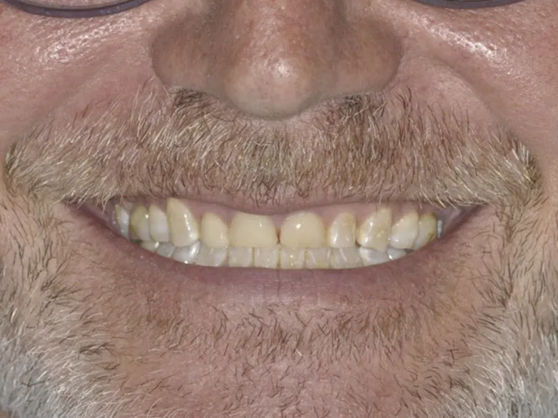 case 0113 smile before photo