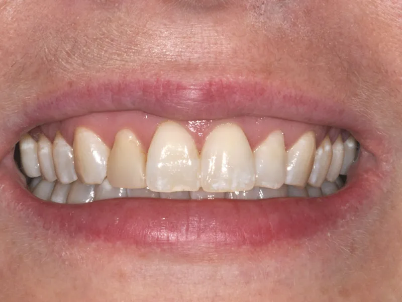 case 013 smile before photo
