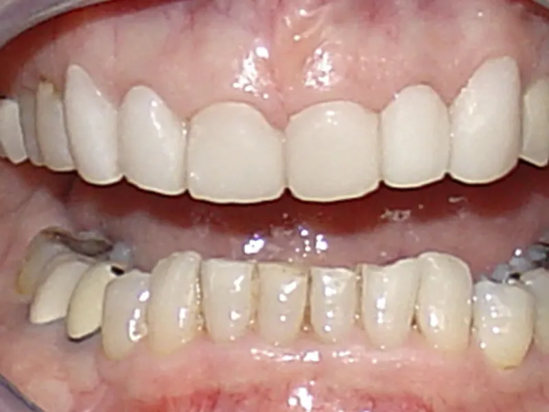 case 015 retracted after photo