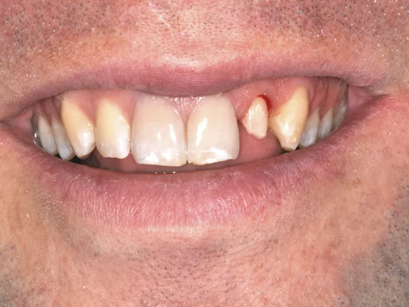 case 018 smile before photo