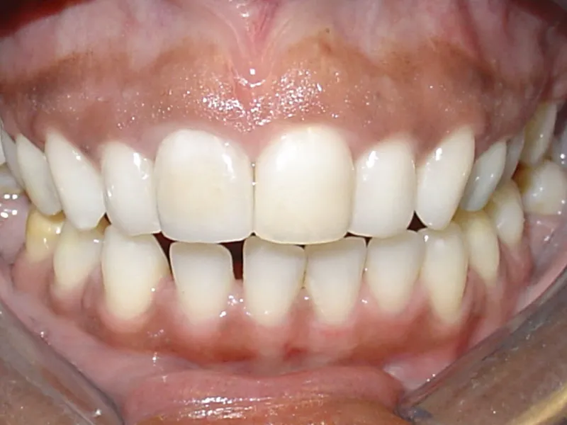 case 024 retracted after photo
