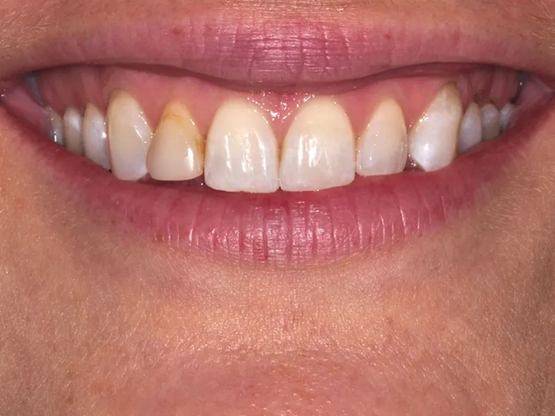 case 025 smile before photo