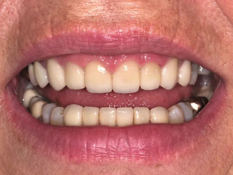case 027 smile after photo