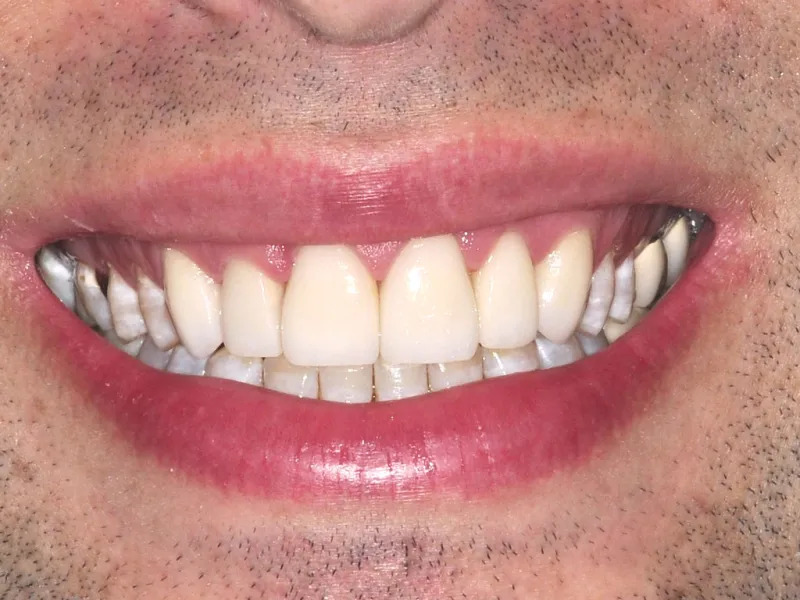 case 030 smile after photo