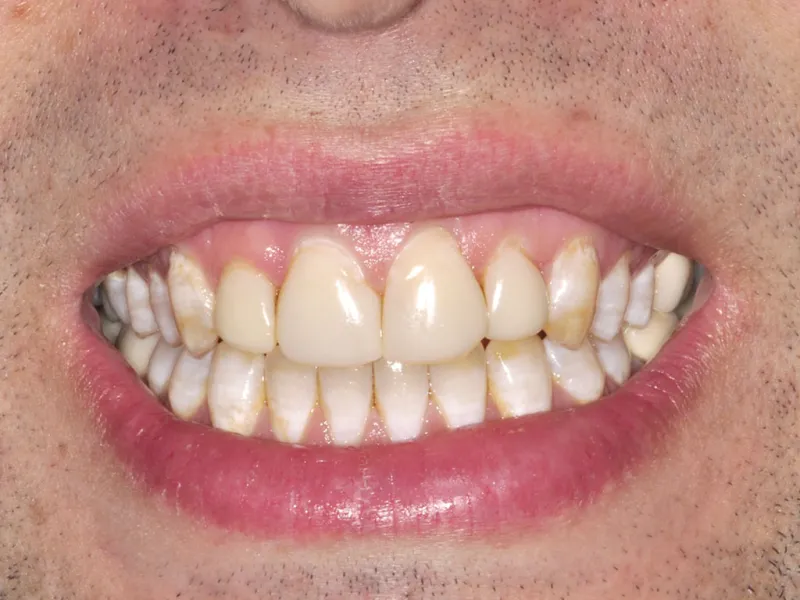 case 030 smile before photo