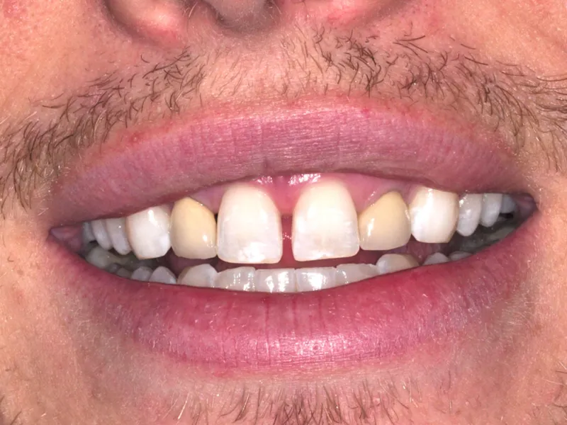 case 033 smile before photo