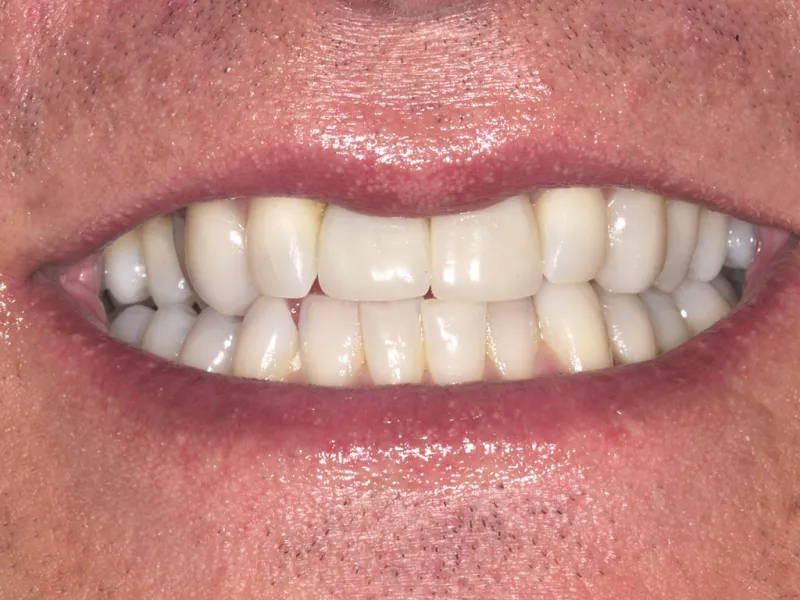 case 035 smile after photo