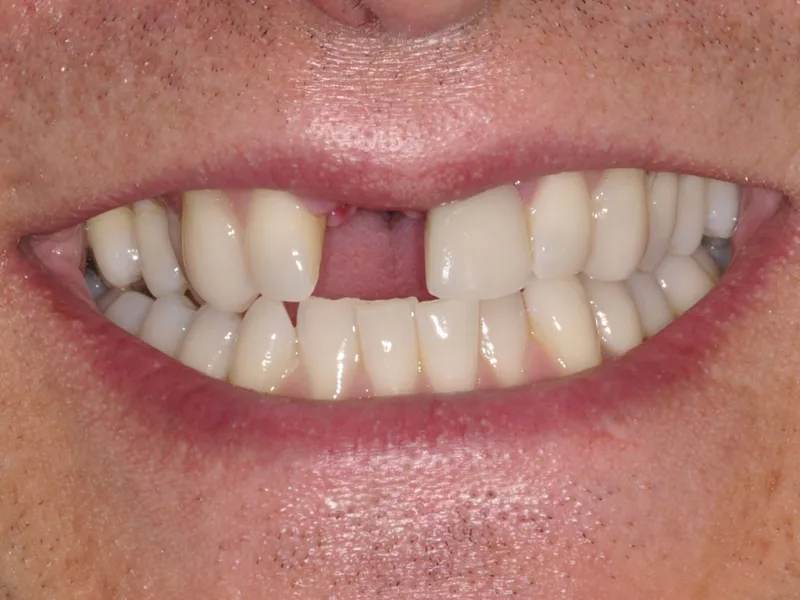 case 035 smile before photo