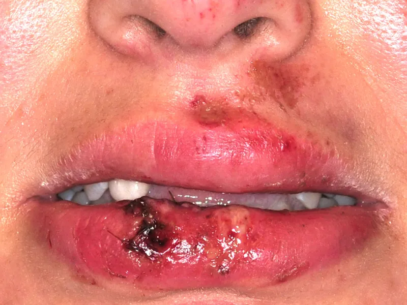 case 039 smile before photo